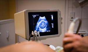 孕妇咳嗽对胎儿有影响吗